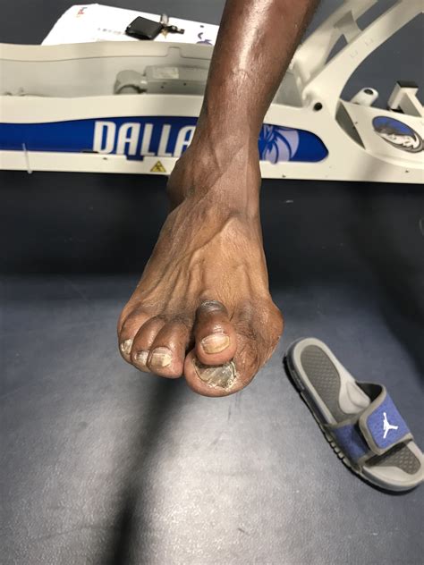 Darrell armstrong feet. Things To Know About Darrell armstrong feet. 